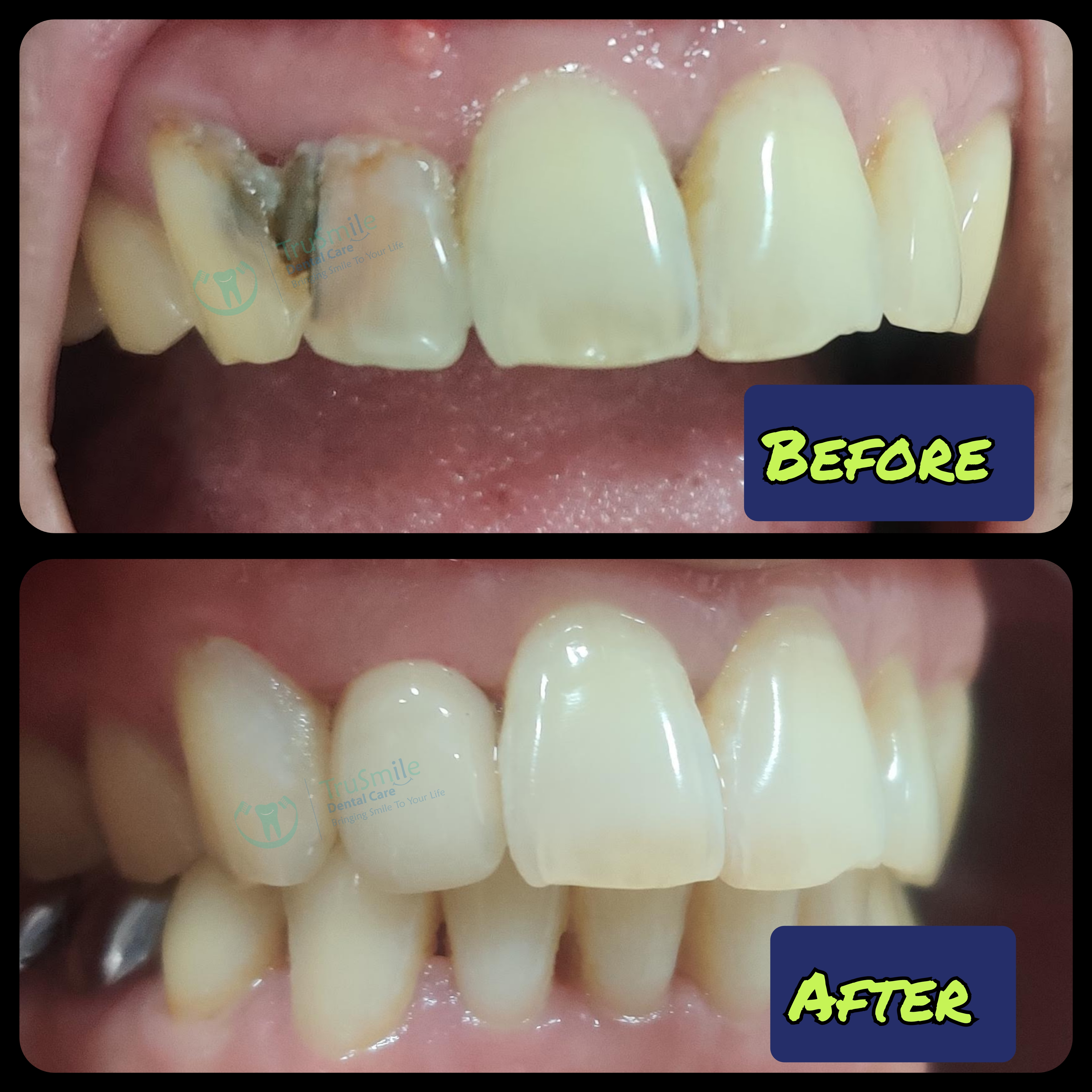 Smile Design 12